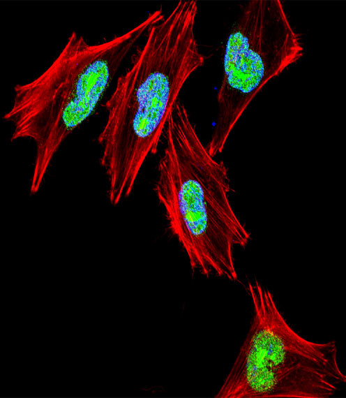 TBX1 Antibody in Immunocytochemistry (ICC/IF)