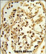 TBX1 Antibody in Immunohistochemistry (Paraffin) (IHC (P))