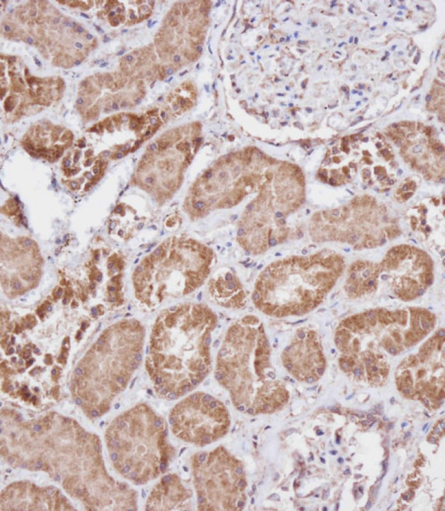 FBXL5 Antibody in Immunohistochemistry (Paraffin) (IHC (P))