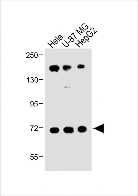 FBXL5 Antibody in Western Blot (WB)