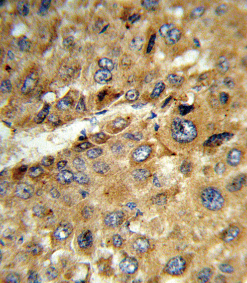 TAT Antibody in Immunohistochemistry (Paraffin) (IHC (P))