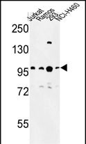 BCL11A Antibody in Western Blot (WB)