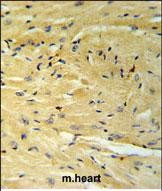 GNAT1 Antibody in Immunohistochemistry (Paraffin) (IHC (P))