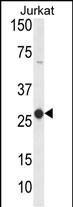 CD160 Antibody in Western Blot (WB)