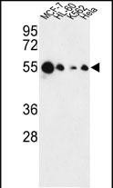 AIM2 Antibody in Western Blot (WB)