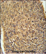 ATG13 Antibody in Immunohistochemistry (Paraffin) (IHC (P))