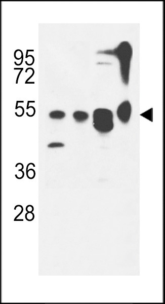 ATG13 Antibody in Western Blot (WB)