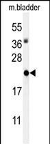 ID4 Antibody in Western Blot (WB)