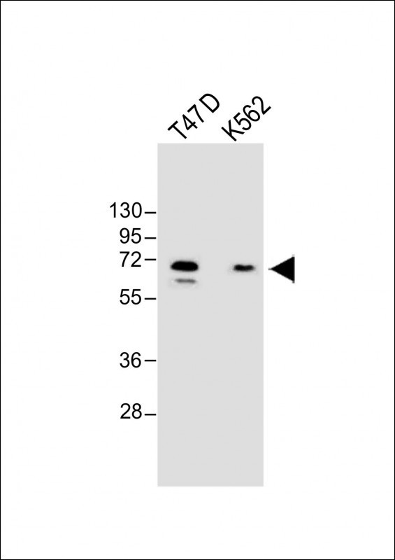 YTHDF3 Antibody in Western Blot (WB)