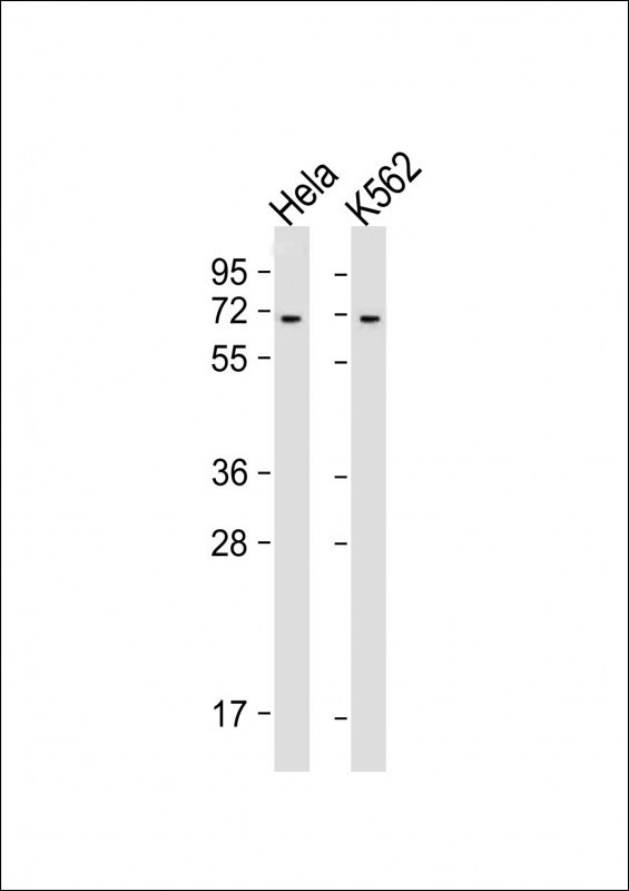 YTHDF3 Antibody in Western Blot (WB)