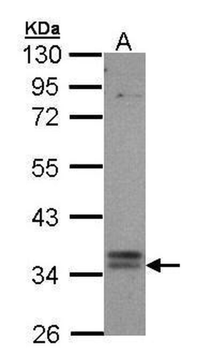 TGR5 Antibody in Western Blot (WB)