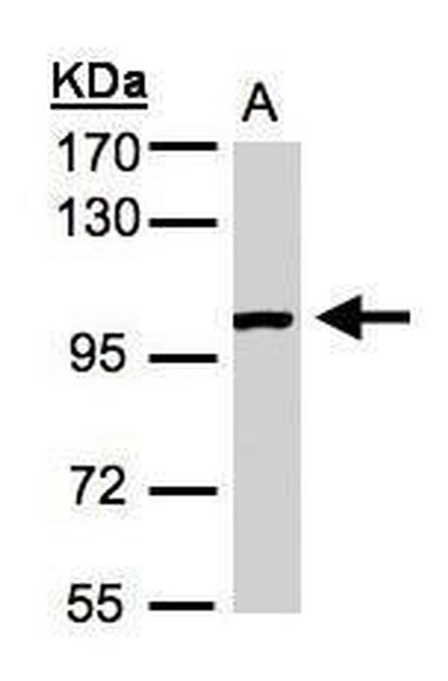 ABR Antibody in Western Blot (WB)