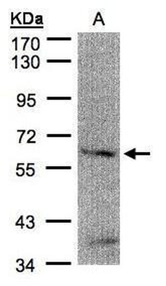 FANCG Antibody in Western Blot (WB)