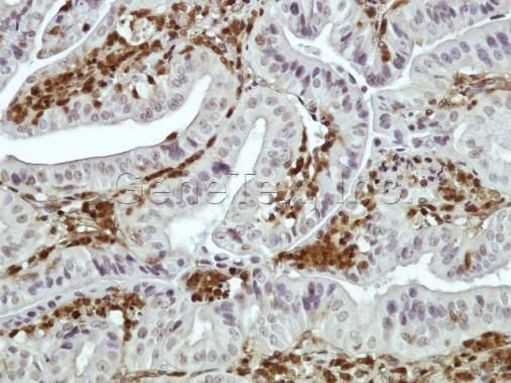 DAB2 Antibody in Immunohistochemistry (IHC)