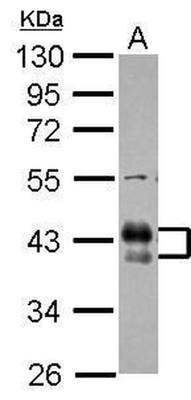 FCGR2B Antibody in Western Blot (WB)