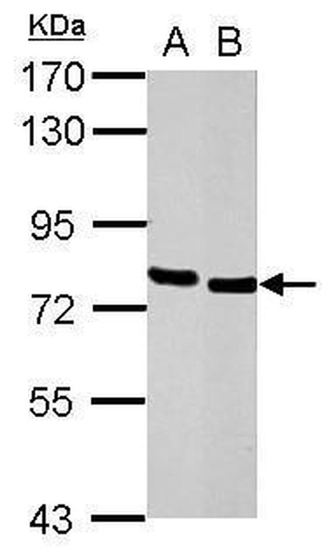 HCLS1 Antibody in Western Blot (WB)