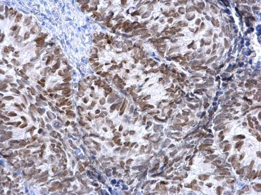 FOXA1 Antibody in Immunohistochemistry (Paraffin) (IHC (P))