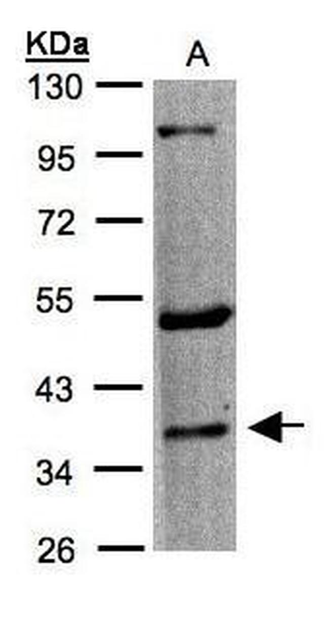 HTR1F Antibody in Western Blot (WB)