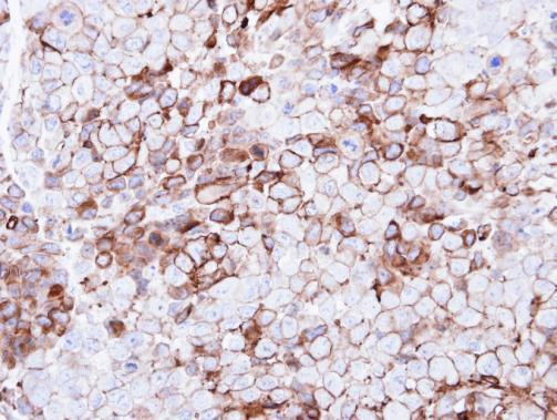 P2Y13 Antibody in Immunohistochemistry (Paraffin) (IHC (P))