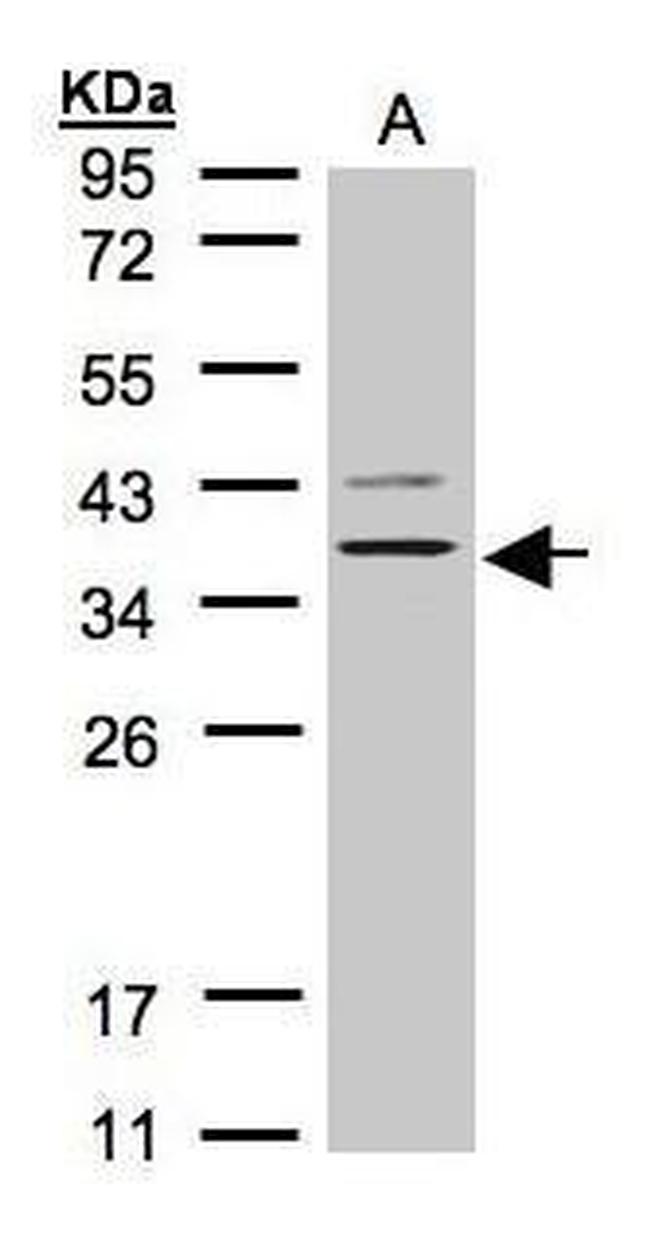 P2Y13 Antibody in Western Blot (WB)