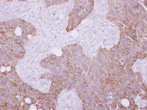 Cytokeratin 15 Antibody in Immunohistochemistry (Paraffin) (IHC (P))