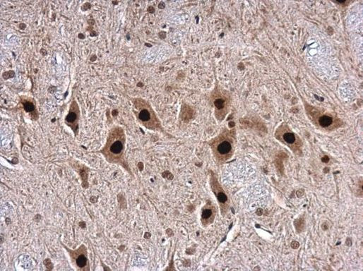 TDP-43 Antibody in Immunohistochemistry (Paraffin) (IHC (P))