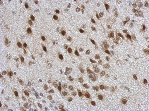 TDP-43 Antibody in Immunohistochemistry (Paraffin) (IHC (P))