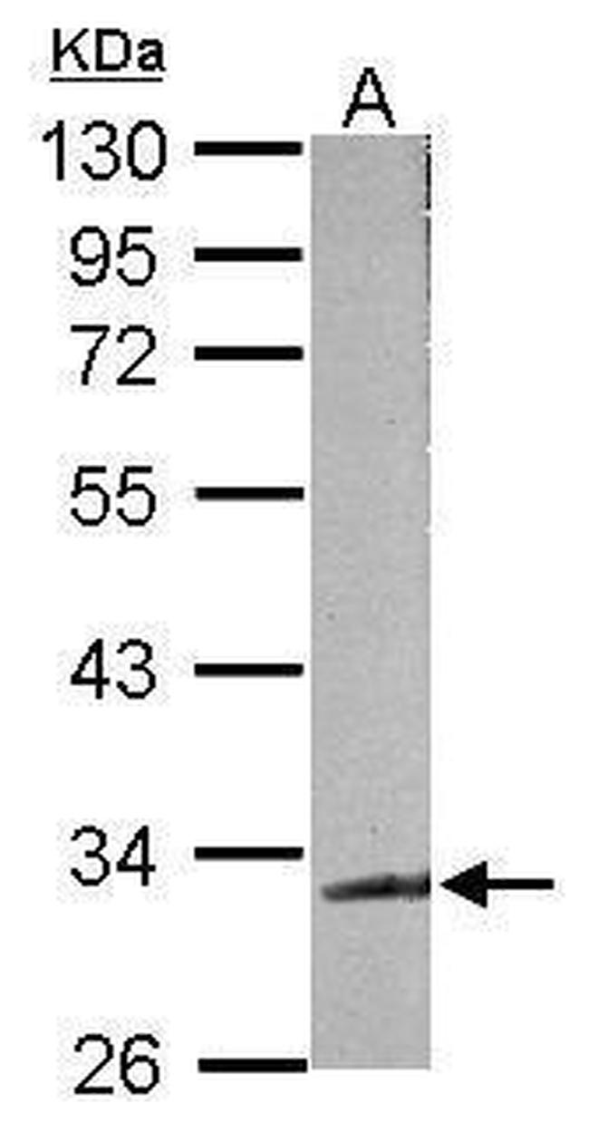 TDP-43 Antibody in Western Blot (WB)