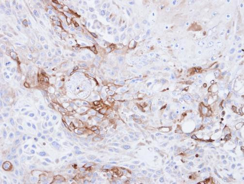 CD36 Antibody in Immunohistochemistry (Paraffin) (IHC (P))