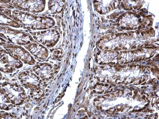 SOCS1 Antibody in Immunohistochemistry (Paraffin) (IHC (P))