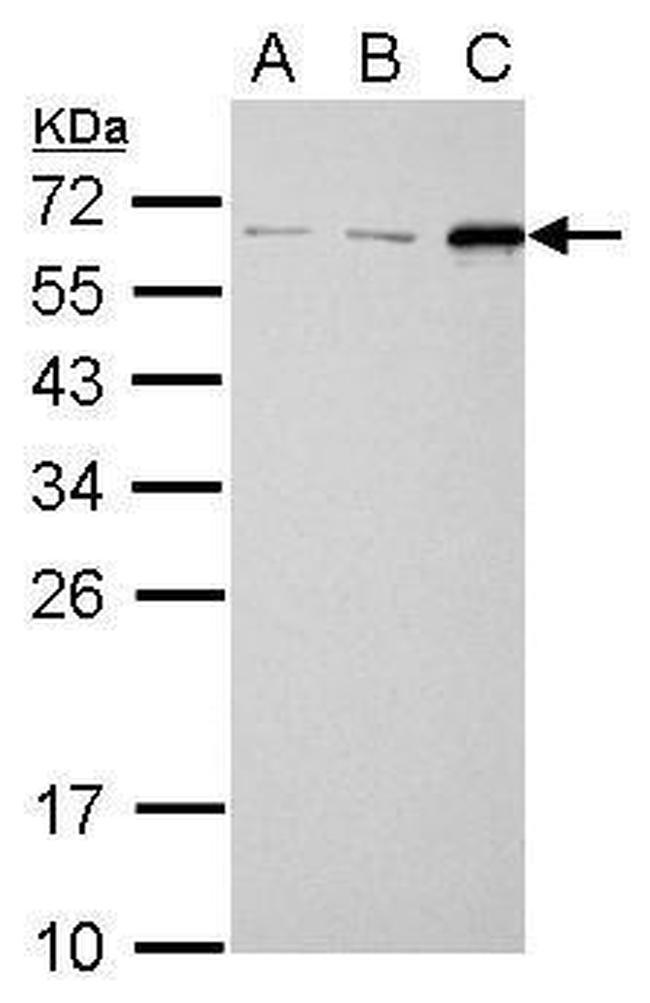 SQSTM1 Polyclonal Antibody (PA5-27247)