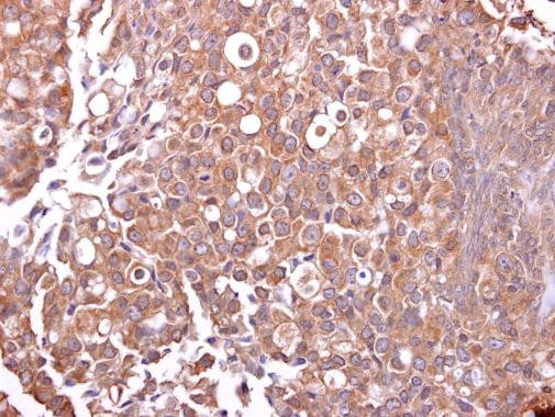 MUC4 Antibody in Immunohistochemistry (Paraffin) (IHC (P))