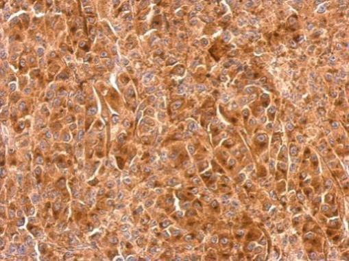 Granulins Antibody in Immunohistochemistry (Paraffin) (IHC (P))