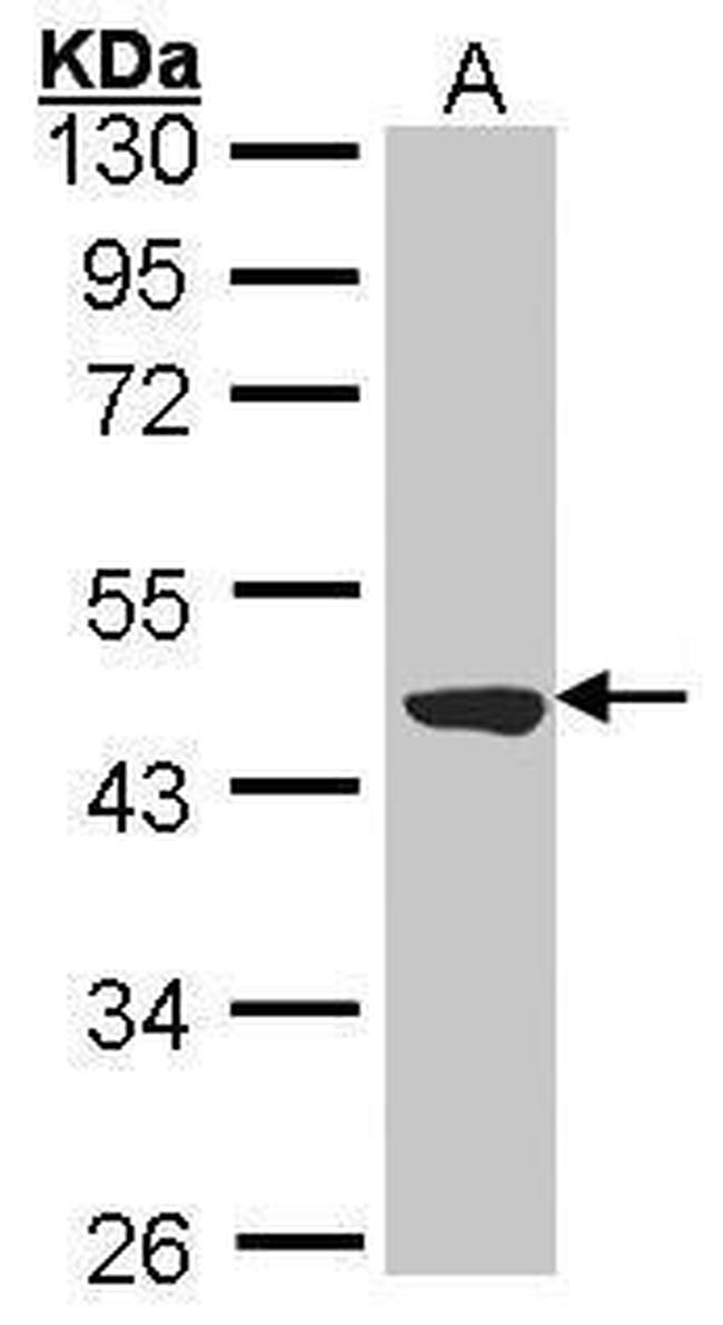TTLL1 Antibody in Western Blot (WB)