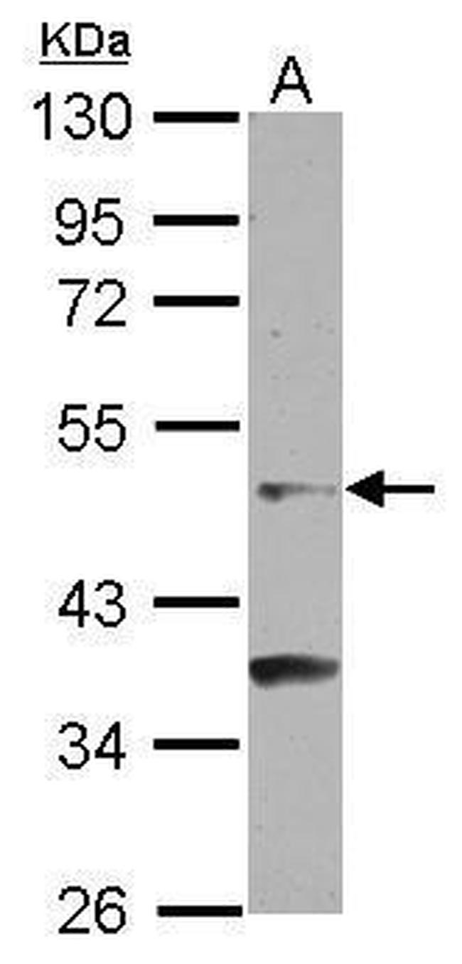 GCNF Antibody in Western Blot (WB)