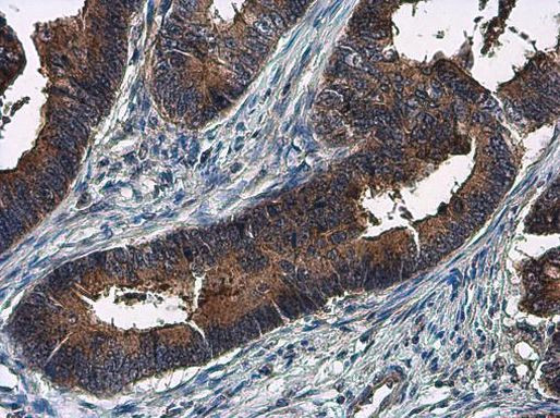 Amphiregulin Antibody in Immunohistochemistry (Paraffin) (IHC (P))