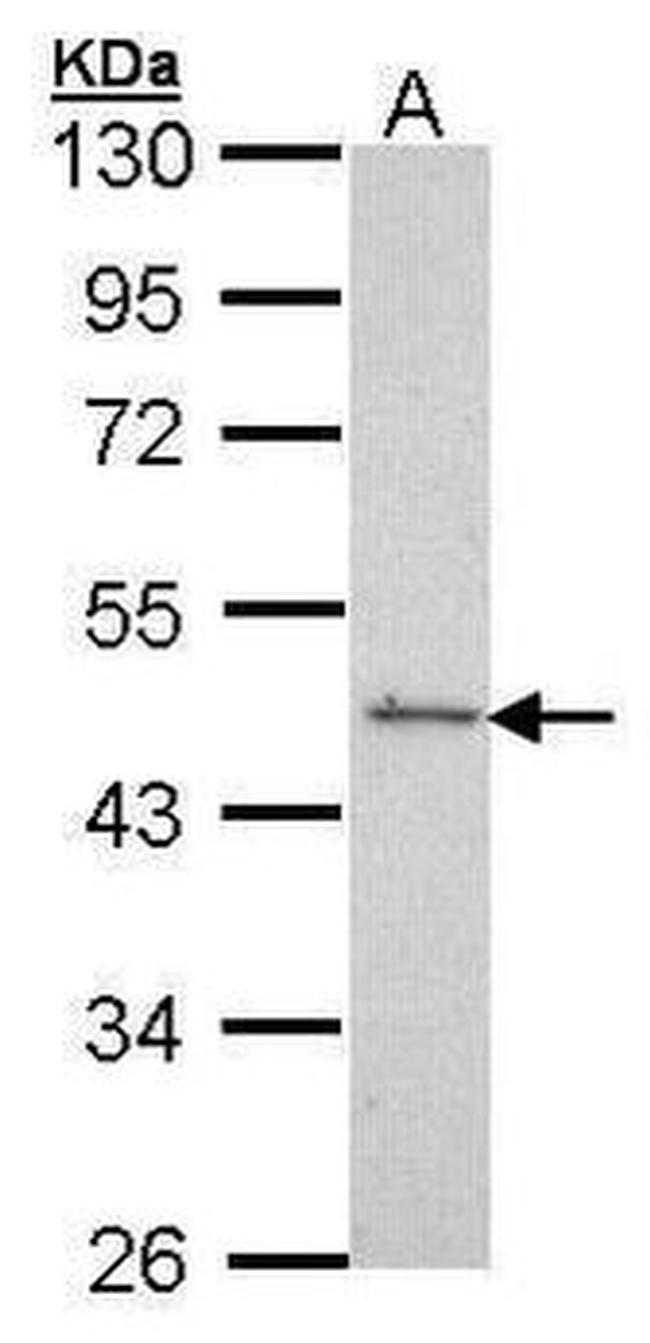 SRF Antibody in Western Blot (WB)