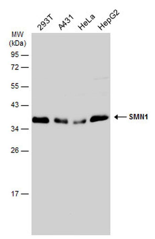 SMN1 Antibody in Western Blot (WB)