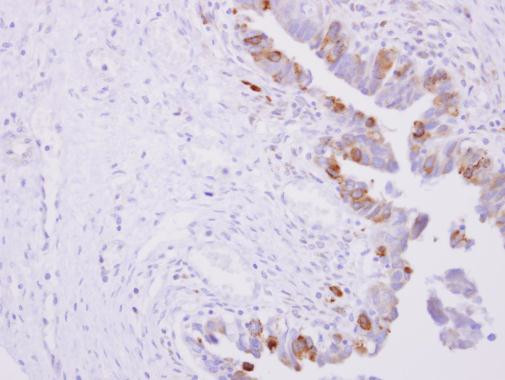 Cytochrome P450 Reductase Antibody in Immunohistochemistry (Paraffin) (IHC (P))