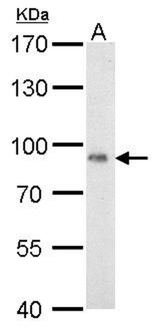 Cytochrome P450 Reductase Antibody in Western Blot (WB)