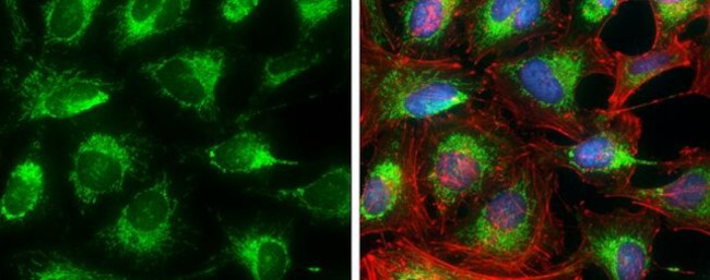 Prohibitin Antibody in Immunocytochemistry (ICC/IF)