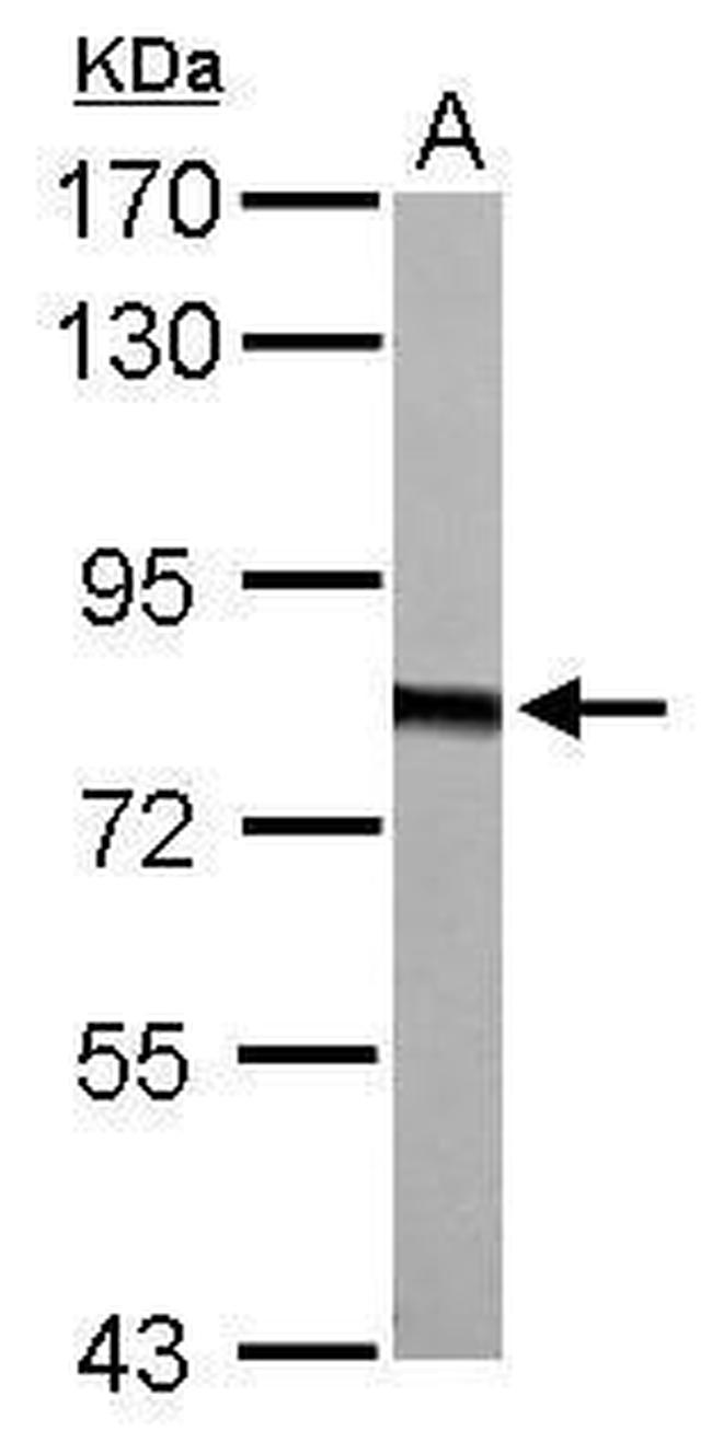 HADHA Antibody in Western Blot (WB)