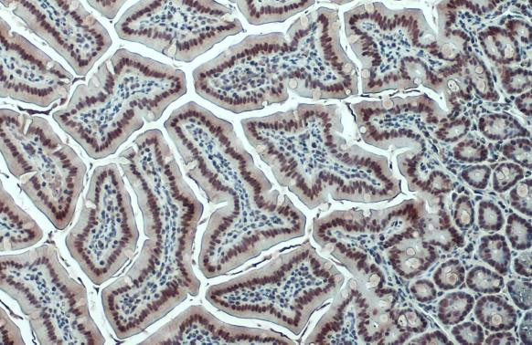 CBP Antibody in Immunohistochemistry (Paraffin) (IHC (P))