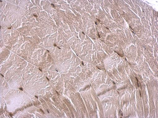 CBP Antibody in Immunohistochemistry (Paraffin) (IHC (P))