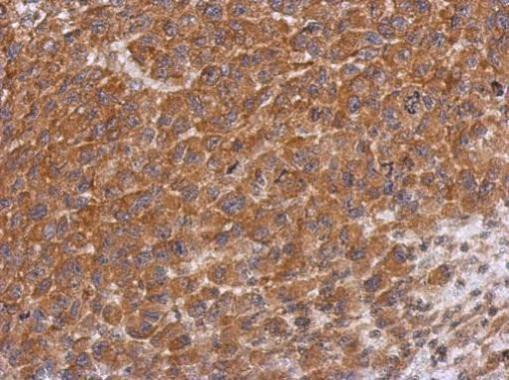 DTNBP1 Antibody in Immunohistochemistry (Paraffin) (IHC (P))