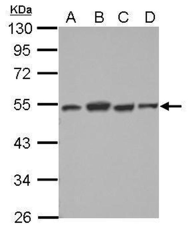 DTNBP1 Antibody in Western Blot (WB)