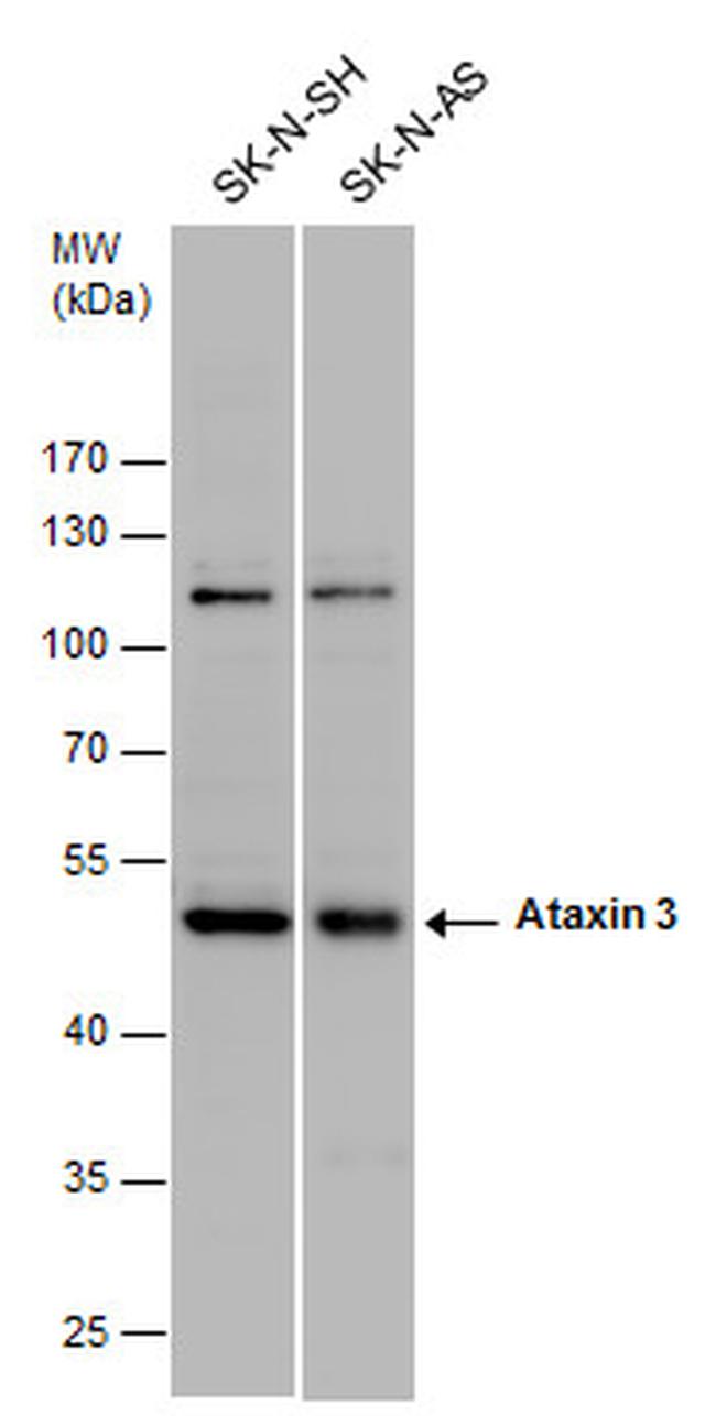 Ataxin 3 Antibody in Western Blot (WB)