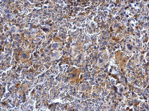 Btk Antibody in Immunohistochemistry (Paraffin) (IHC (P))