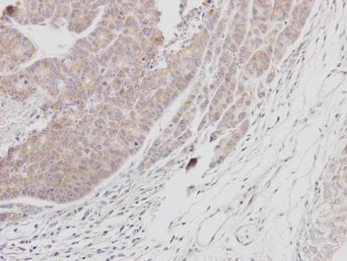 Btk Antibody in Immunohistochemistry (Paraffin) (IHC (P))