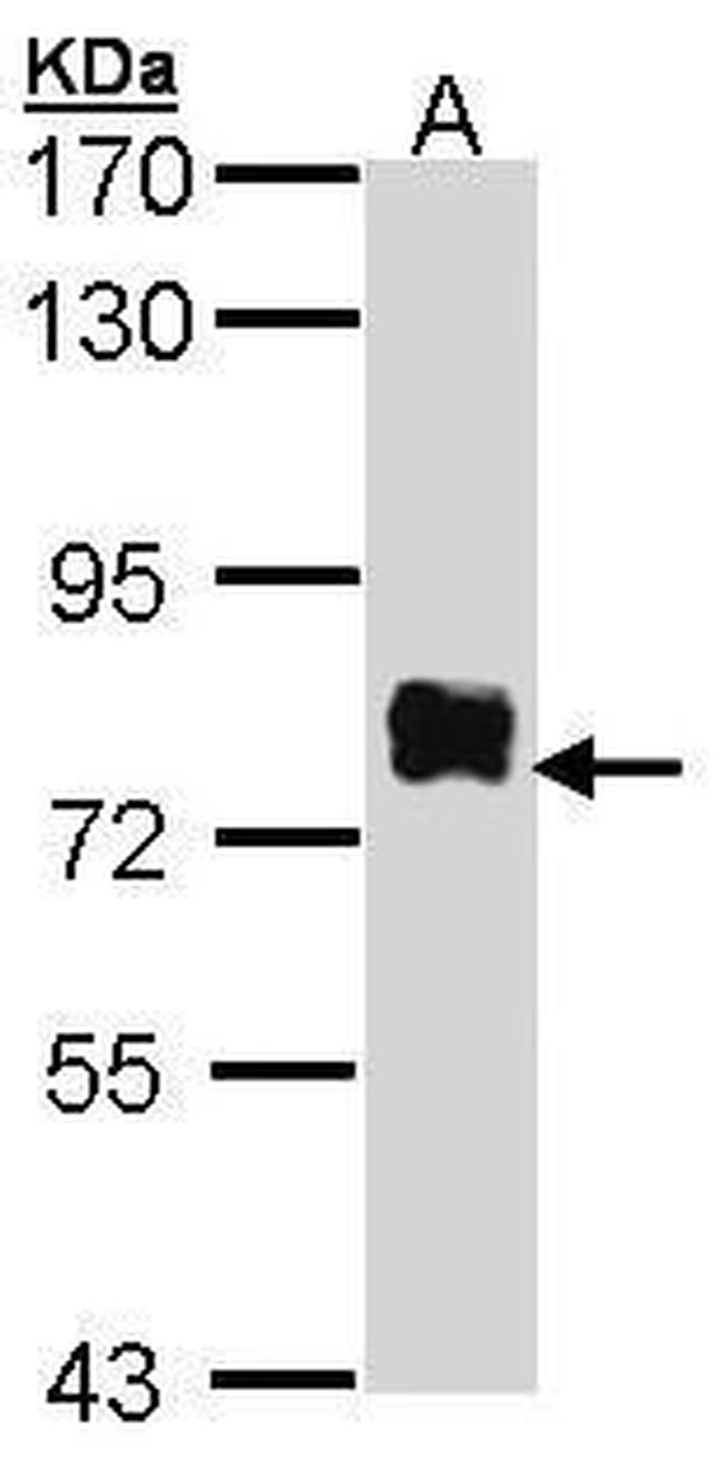 Btk Antibody in Western Blot (WB)